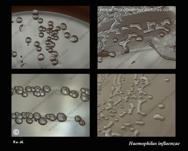 Colonies of mucoid and non-mucoid Haemophilus influenzae h.influenzae colonies comparison